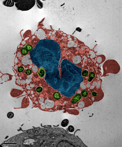 En immuncelle er i ferd med å dø etter Yersinia pestis-infeksjon. Cellmembranen får blæredanning og cellekjernen endrer seg. Grønt: bakterier. Rødt: celleinnhold. Blått: Cellekjerne. (Weng et al. PNAS 2014, 111:7391)