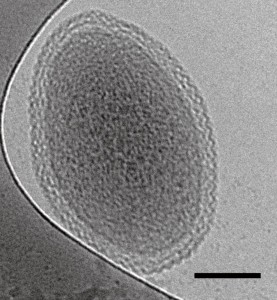Bilde av en ultra-liten bakteriecelle, tatt ved hjelp av kryo-transmisjonselektronmikroskopi. Linjen som viser skalaen er 100 nanometer lang. Foto: Birgit Luef, UC Berkeley, NTNU