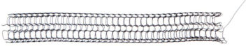 Here's what the new knitted stent looks like. Illustration courtesy of the authors.