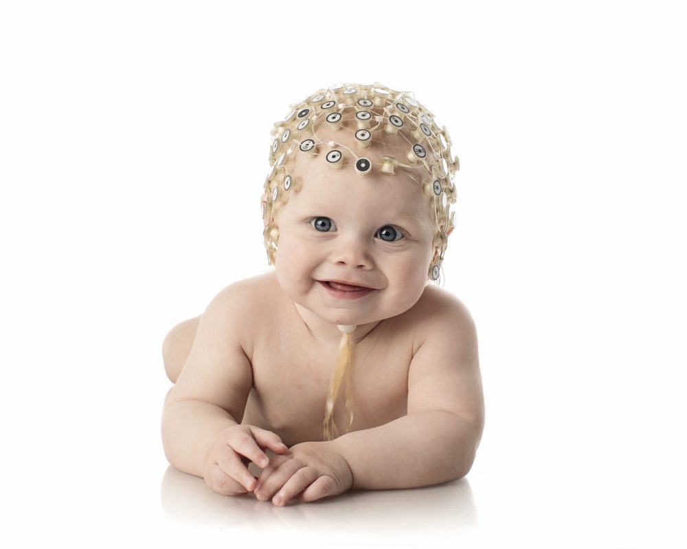 A baby with electrical equipment on it's head