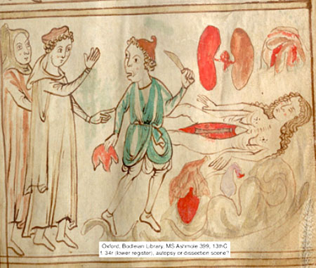 Artwork of dissection of female body from the 13th century.