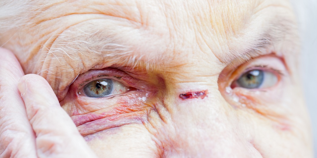 Close-up of a hurt old person