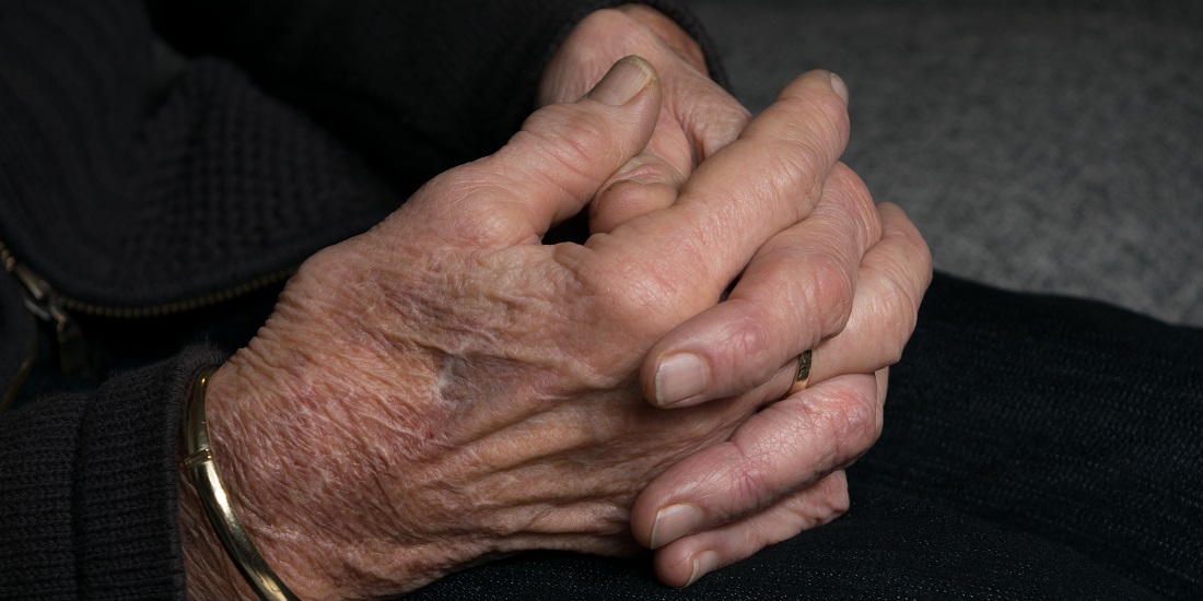 hands deformed by arthritus