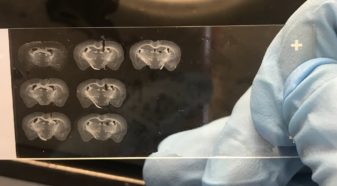 Crossections of rodent brains on plexiglass