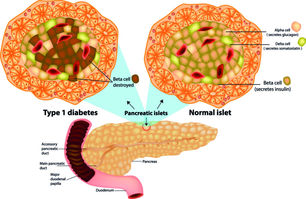 picture of the pancreas