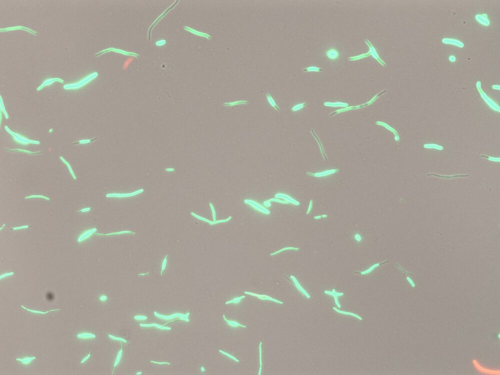 Image from microscope of bacteria