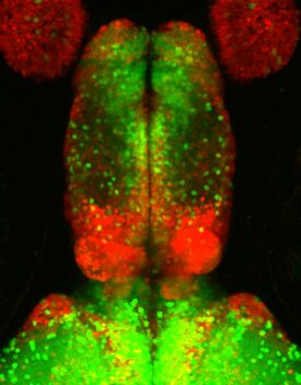 Zebrafish forebrain lighting up.