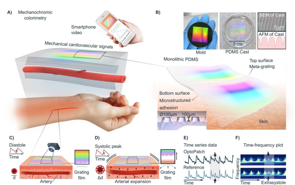 This illustration shows how the combination of a smart patch and a mobile phone works.